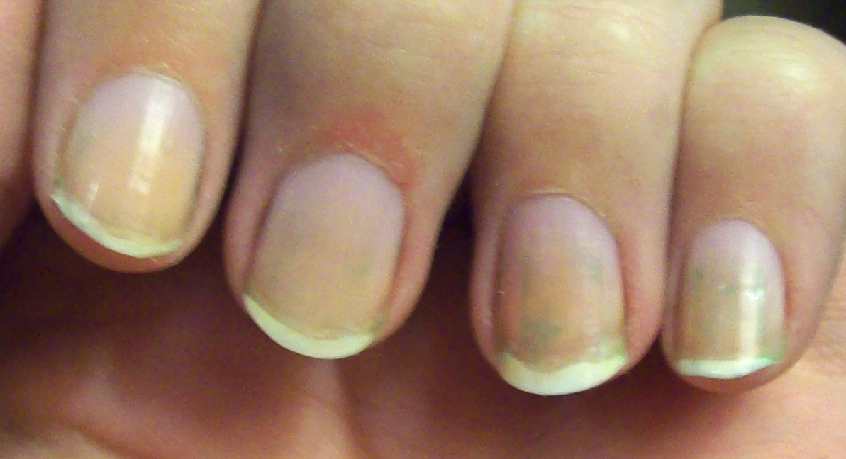 how to remove stains on nails Musely