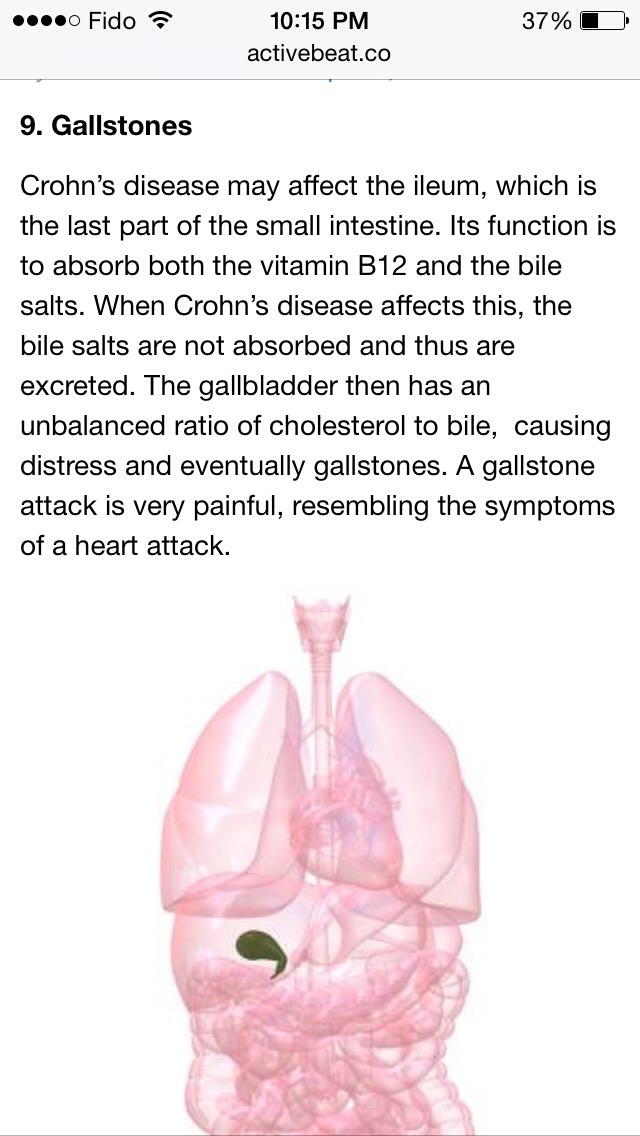 Crohn's Disease Abdominal Pain and Cramping