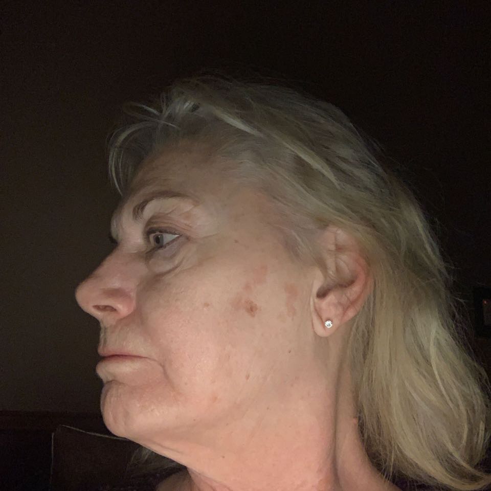 The Spot Cream review photo by andrea R.
