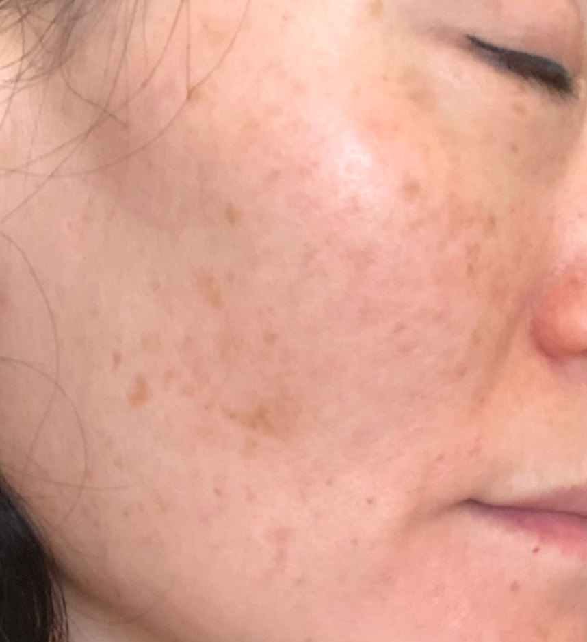The Spot Cream review photo by Annie S.