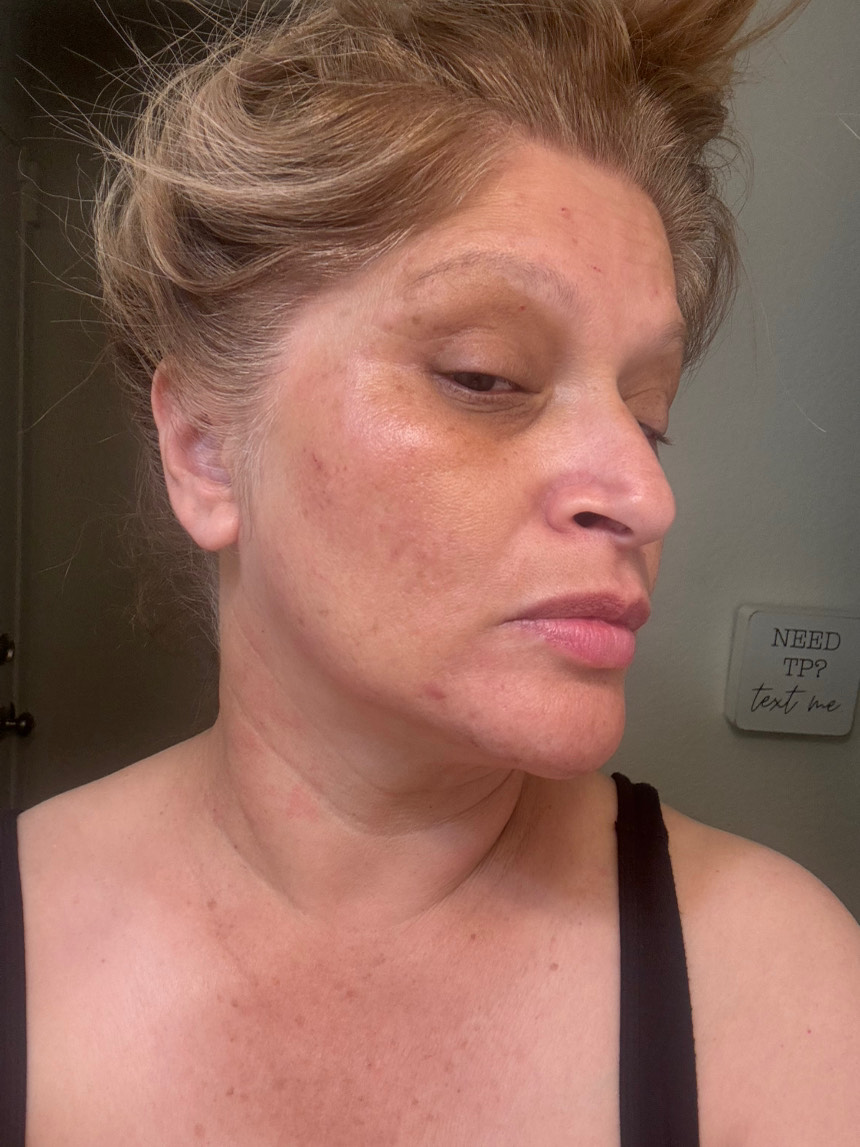 The Spot Cream review photo by Rose S.