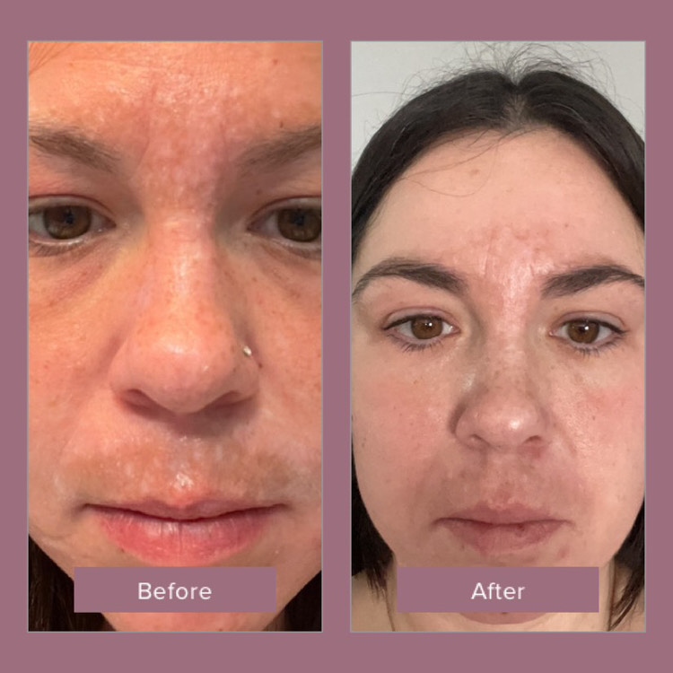 The Spot Cream review photo by Emily M.
