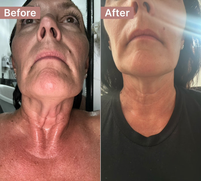 Customer photo