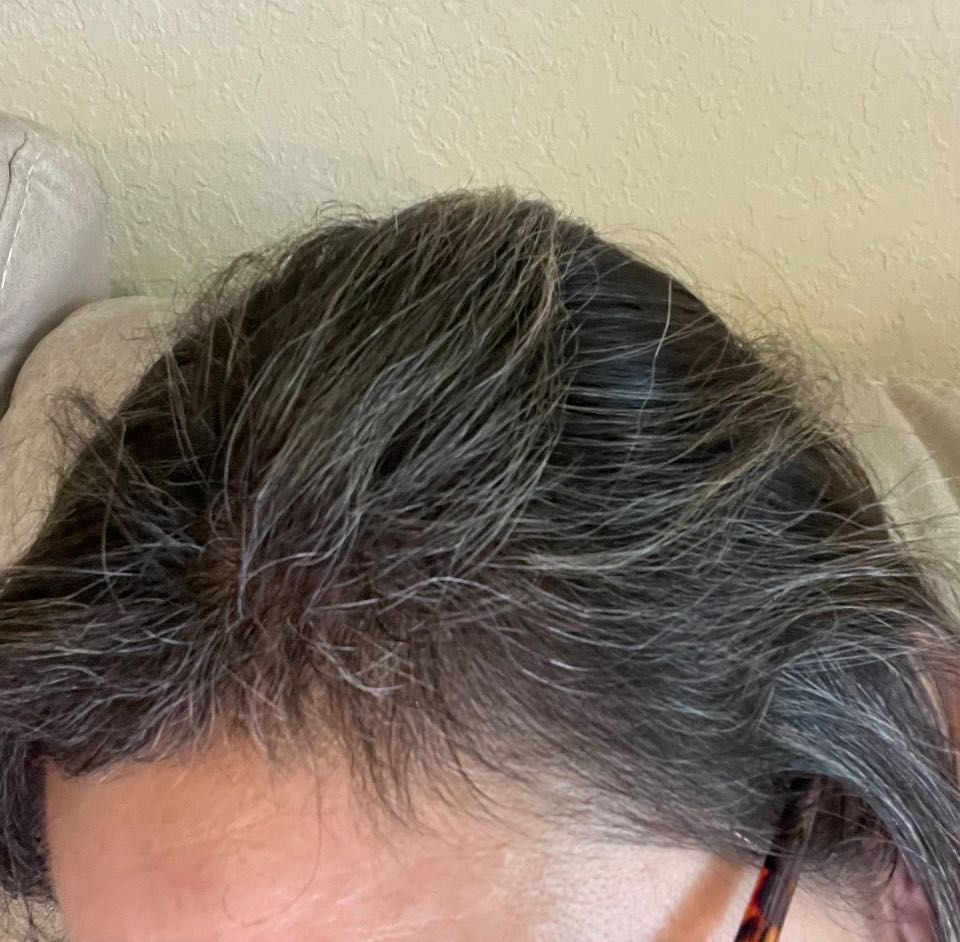 The Hair Pill review photo by Gladys S.