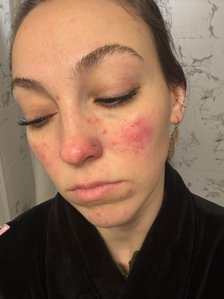 Customer photo