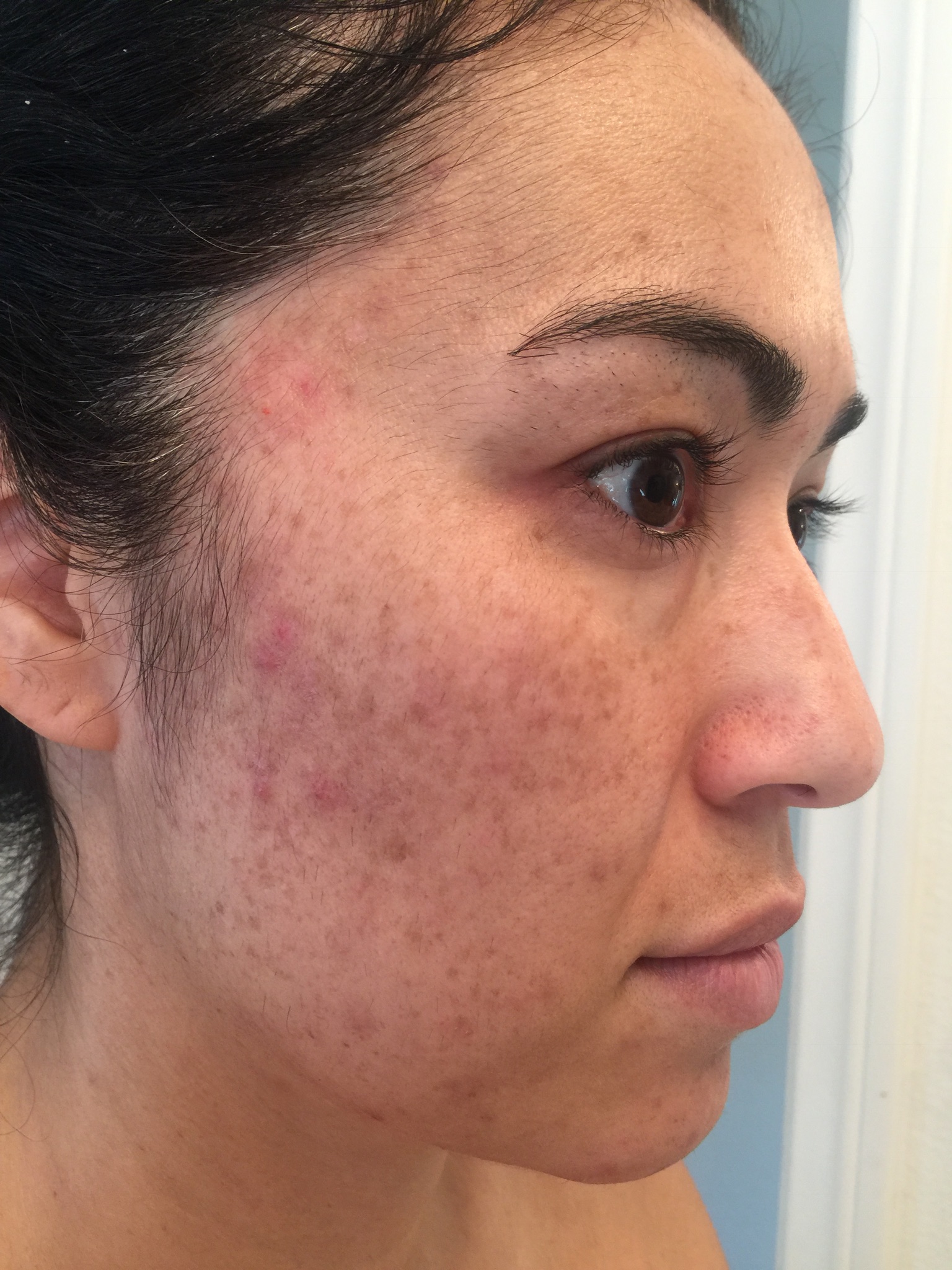 The Spot Cream review photo by Tammy H.