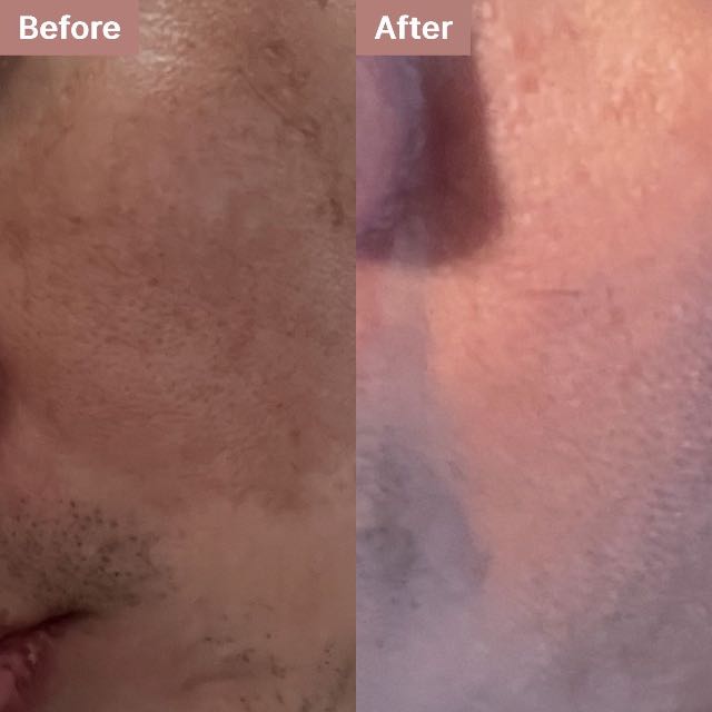 Michael N.'s story