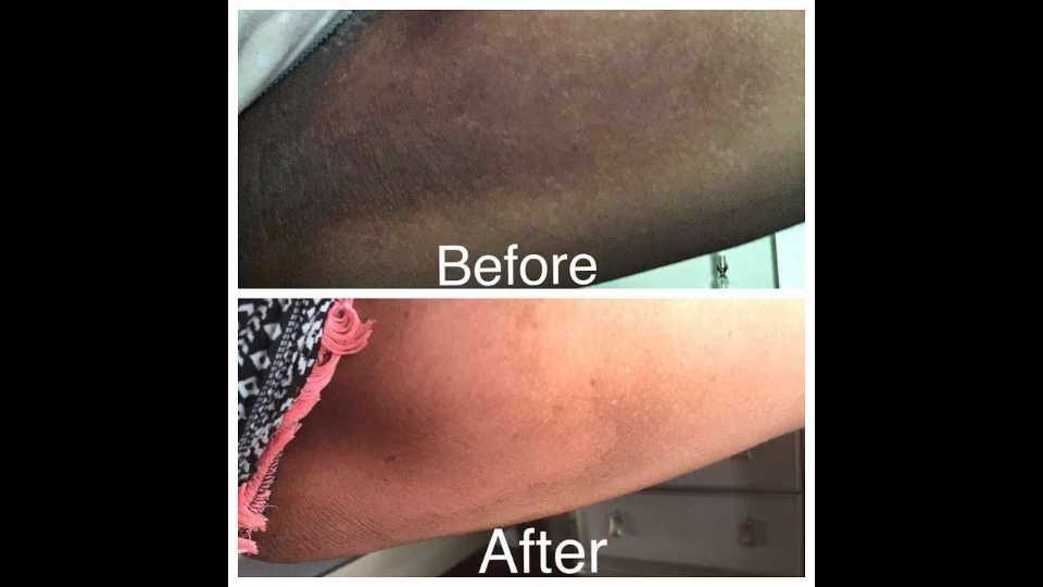 Customer photo