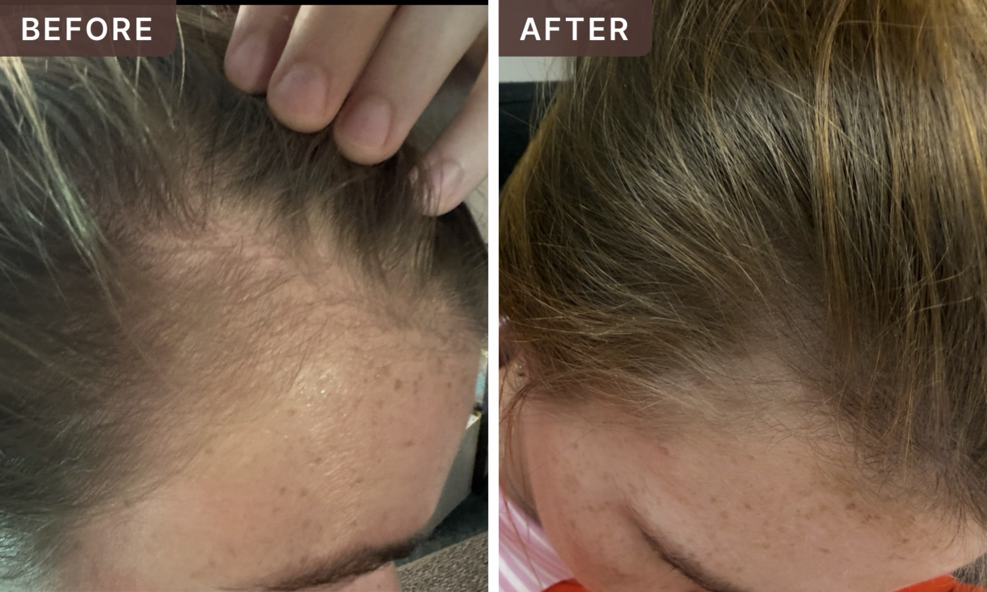 Jessica B. -- before and after, 8 weeks