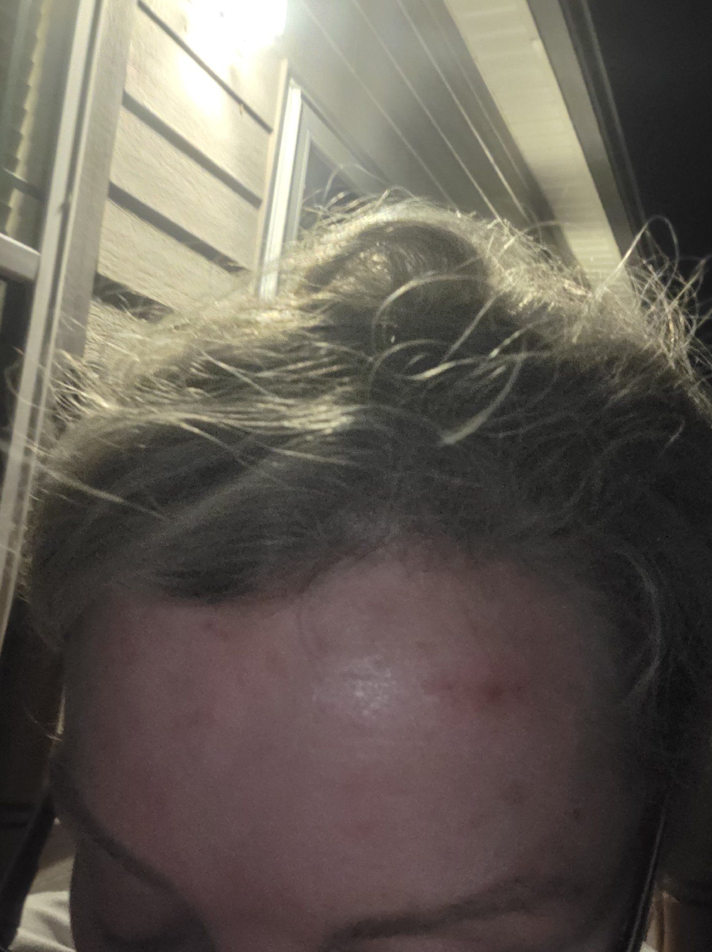 Post attachment 2