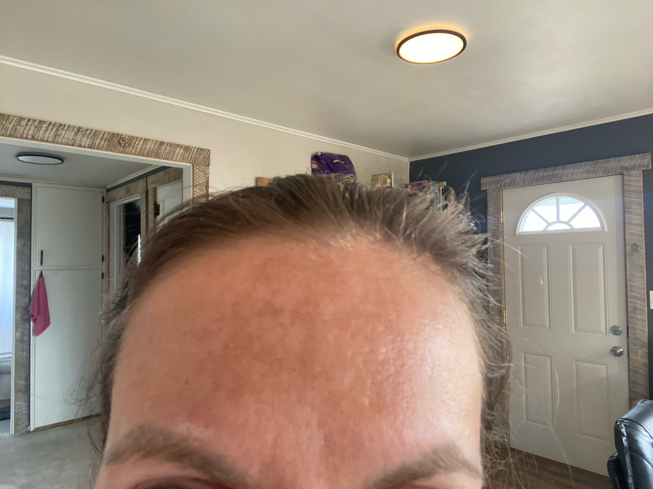 The Spot Cream review photo by Becky W.
