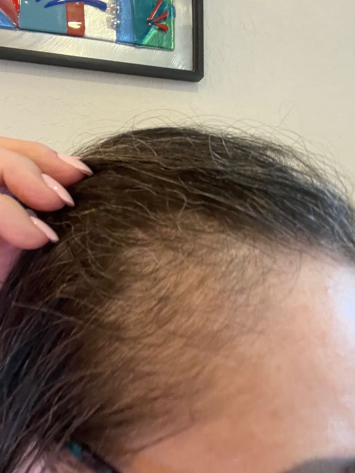 The Hair Pill review photo by Gladys S.