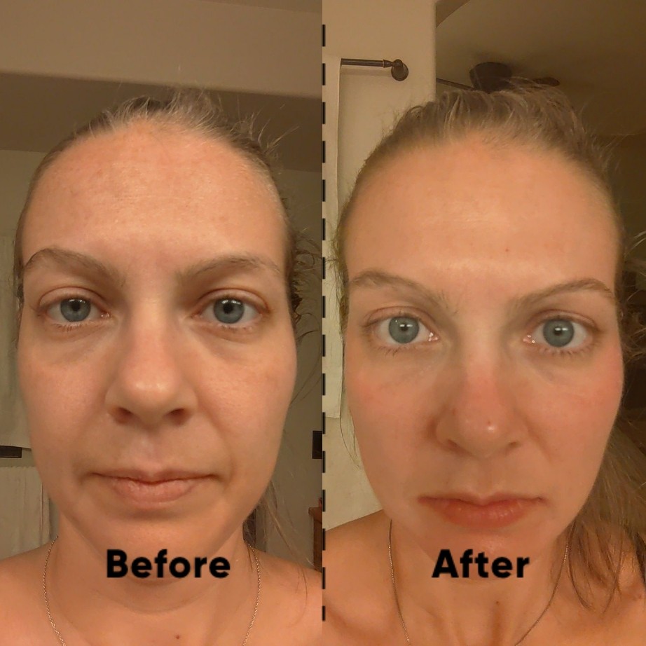 The Spot Cream review photo by Noelle F.