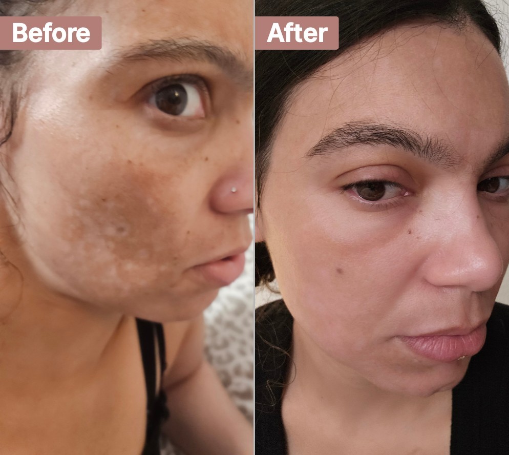 The Spot Cream review photo by Cameron C.