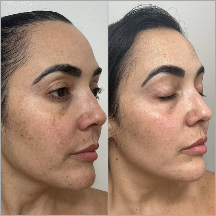 The Spot Cream review photo by Yannis J.