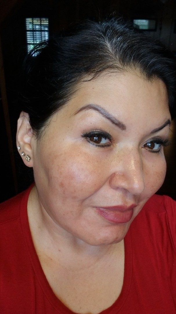 The Spot Cream review photo by Janeth Z.
