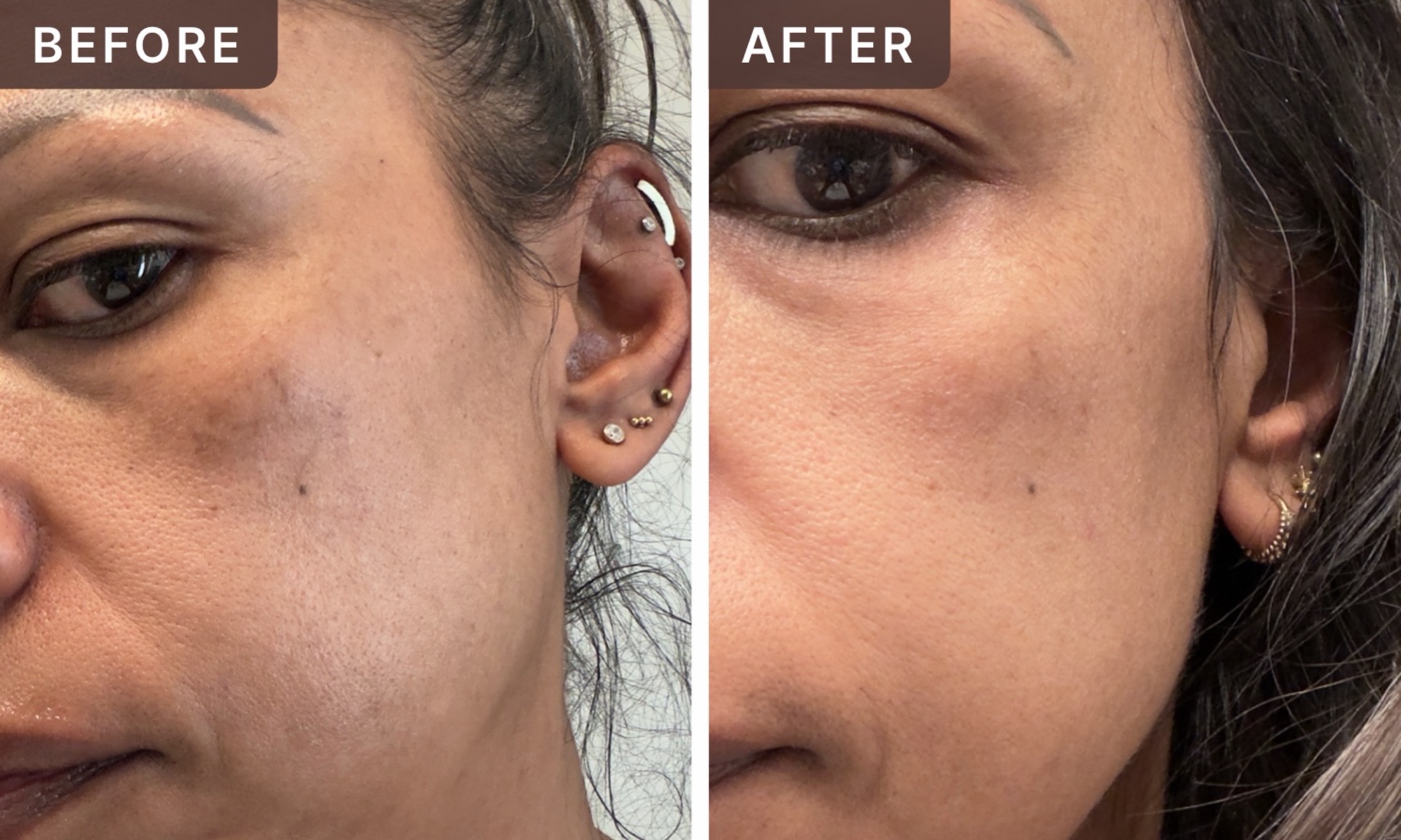 Mereille N. -- before and after, 8 weeks