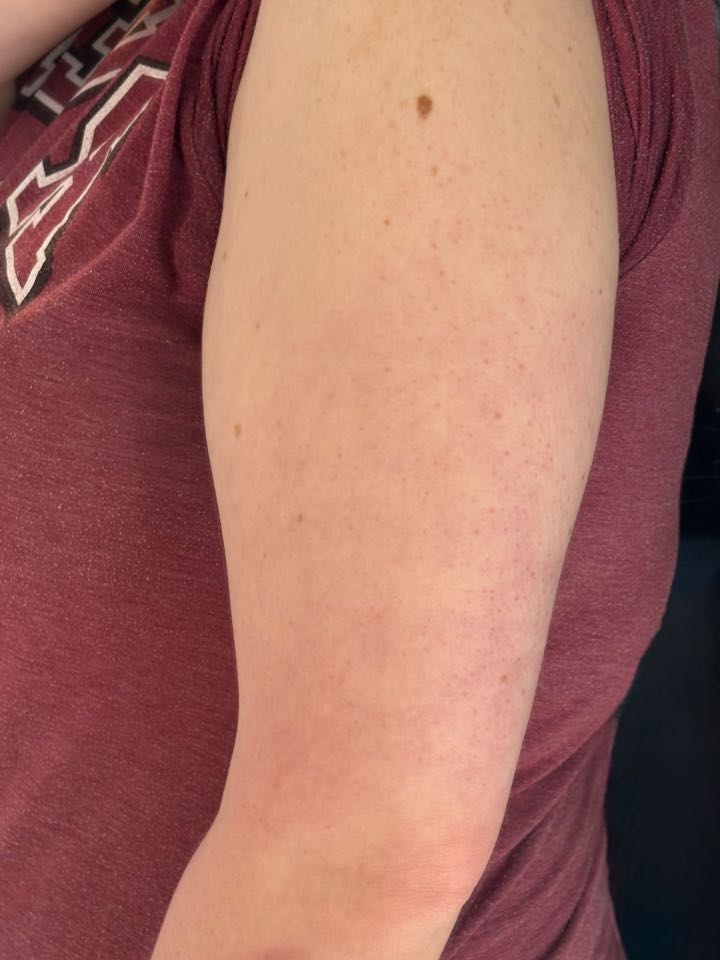 Customer photo