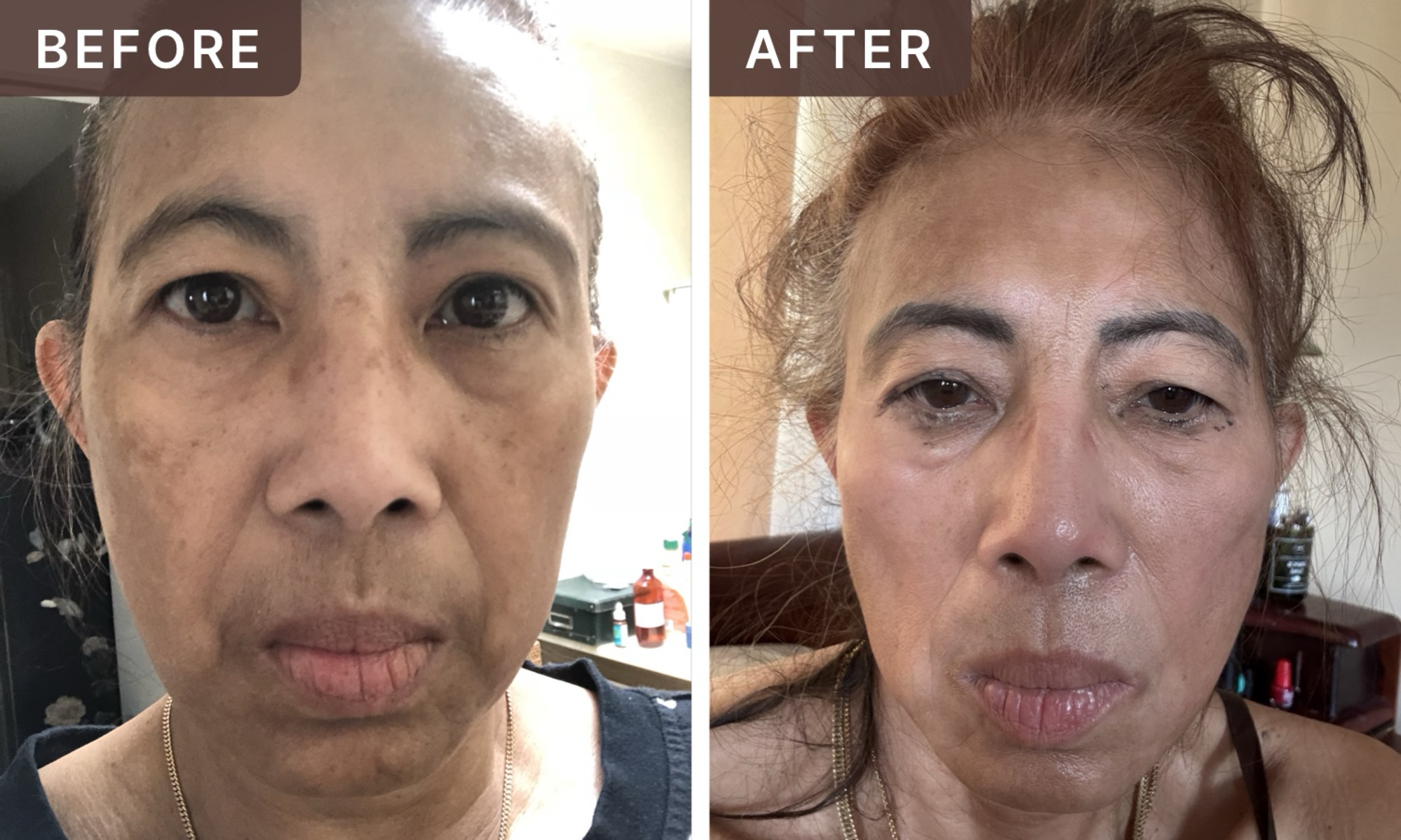 lilia b. -- before and after, 8 weeks