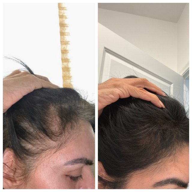 Post attachment 2