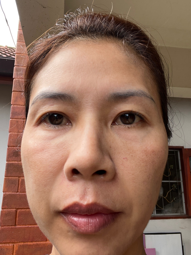 The Spot Cream review photo by Natthacha  B.