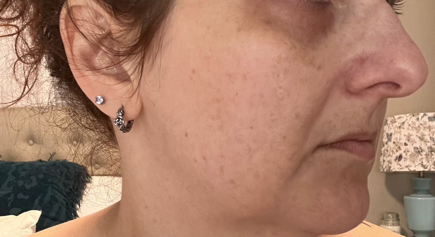 Customer photo