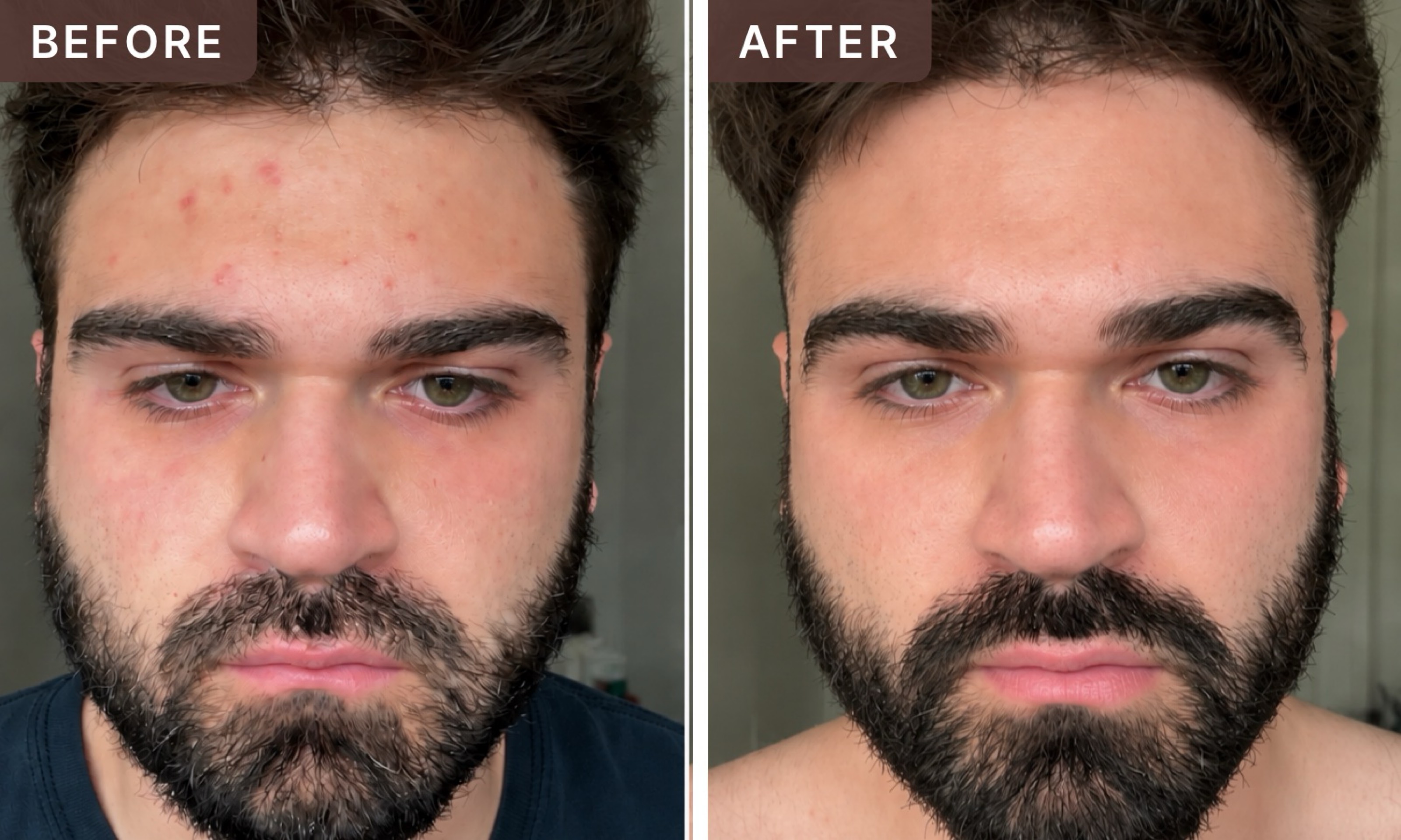 Elijah C. -- before and after, 8 weeks