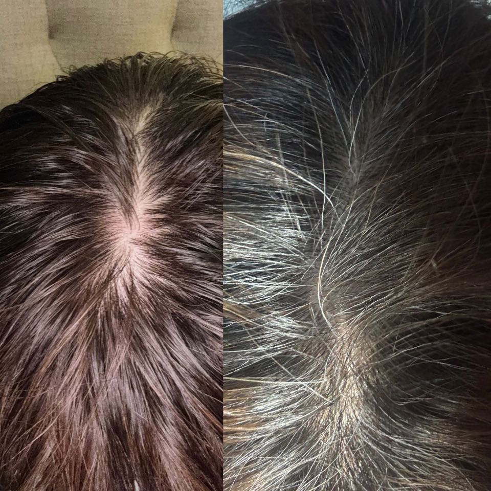 The Hair Pill review photo by Alma R.