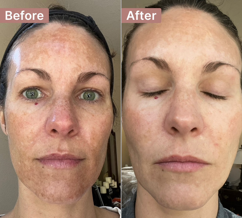 The Spot Cream review photo by Elizabeth M.