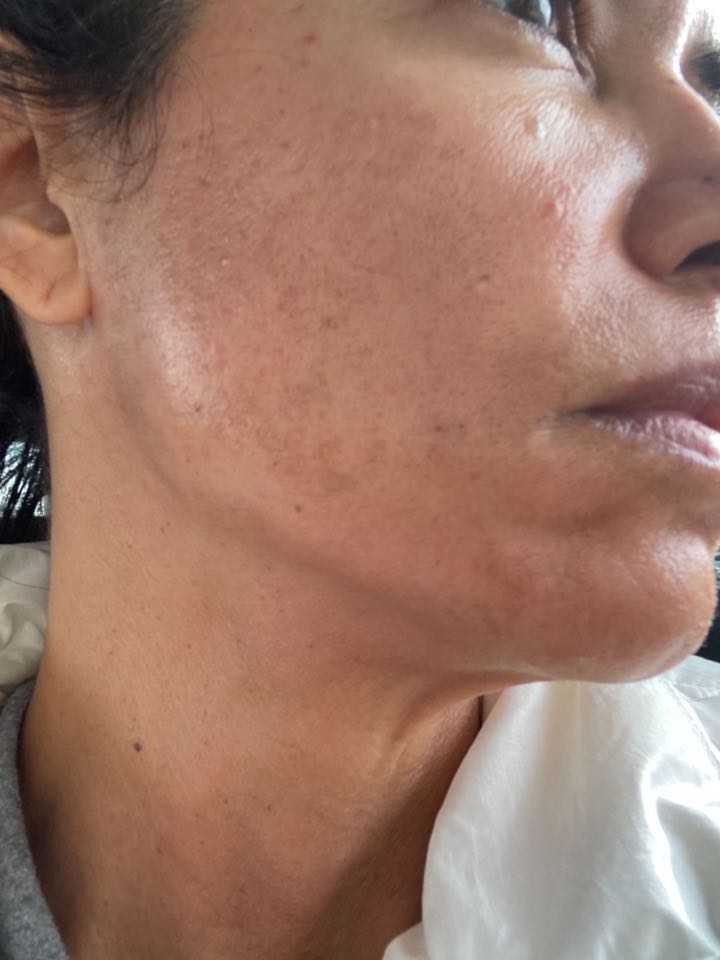 The Spot Cream review photo by julia D.