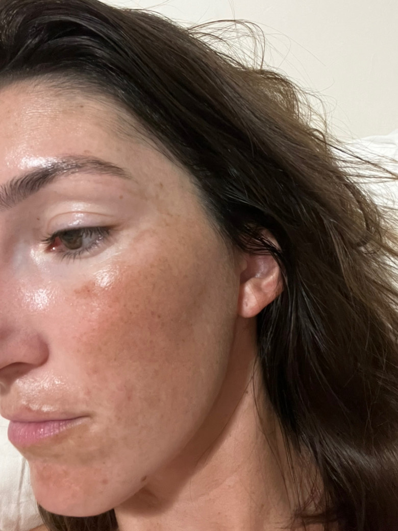 The Spot Cream review photo by Emma K.