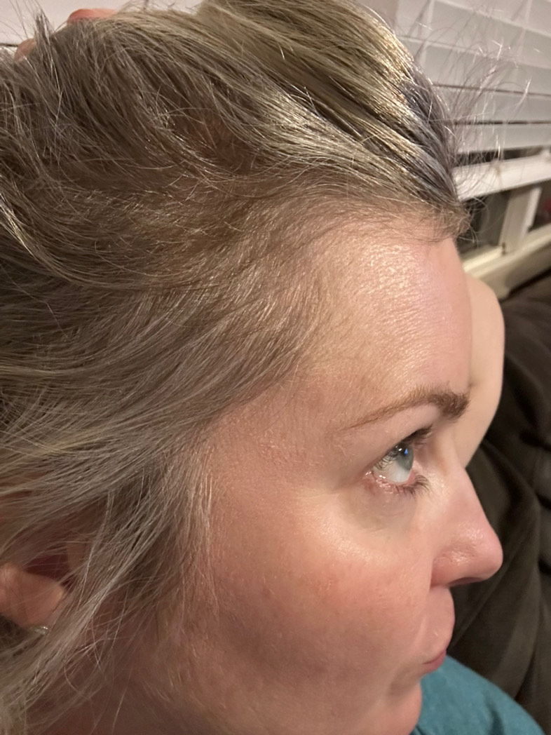 The Hair Pill review photo by Nicole H.