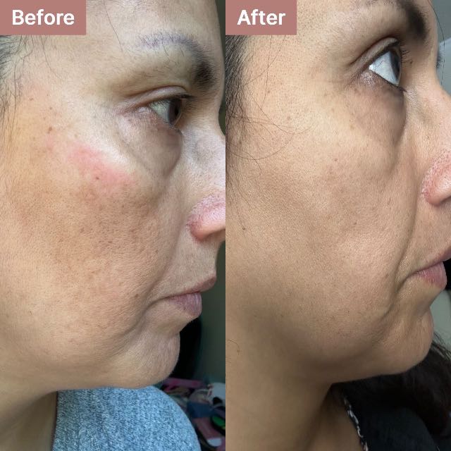 Fabiola C.'s story