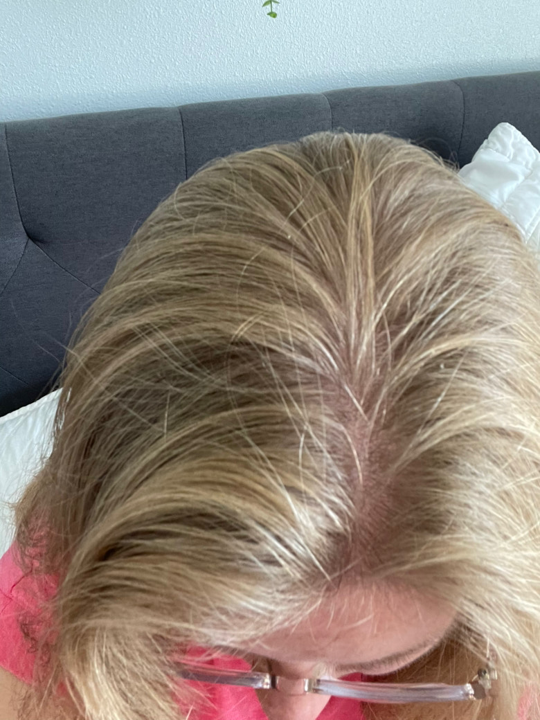 The Hair Pill review photo by Robyn W.