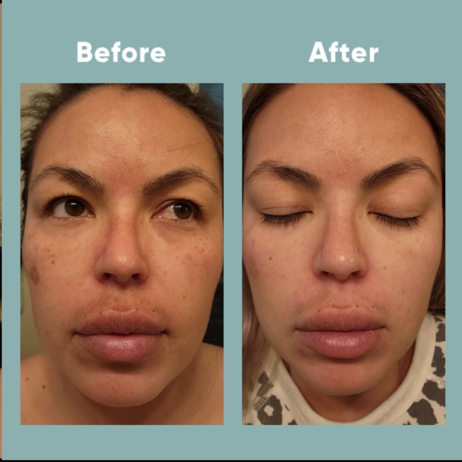 The Spot Cream review photo by Lourdes C.