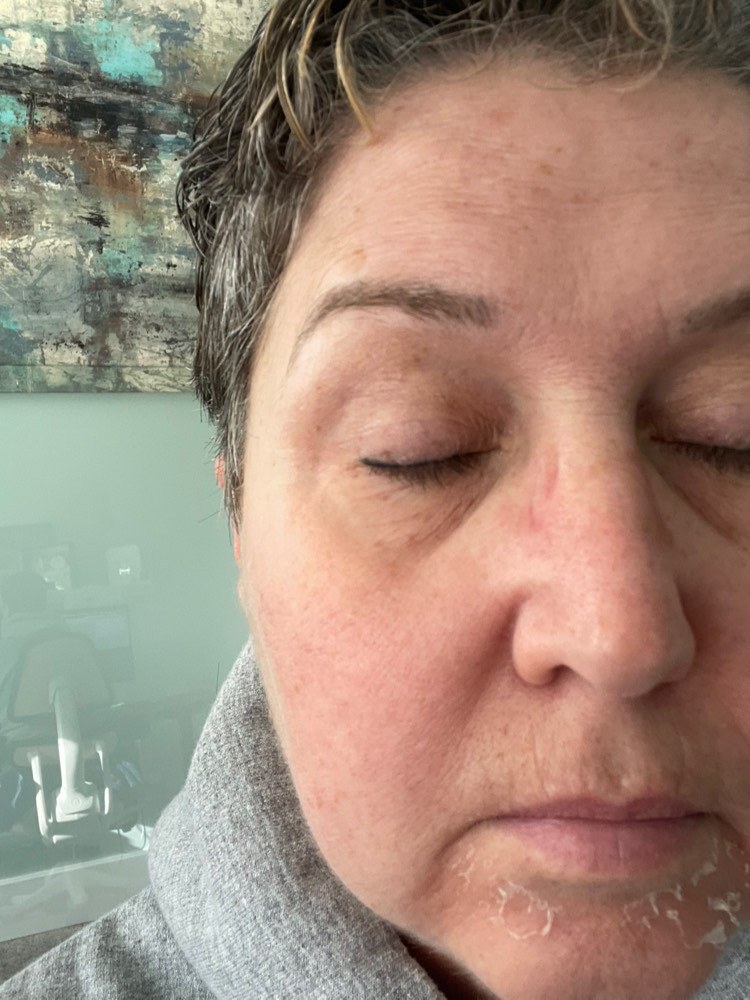 The Eye Serum review photo by Rochelle Primrose P.