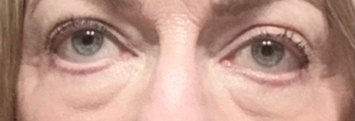 The Eye Serum review photo by Rebecca M.
