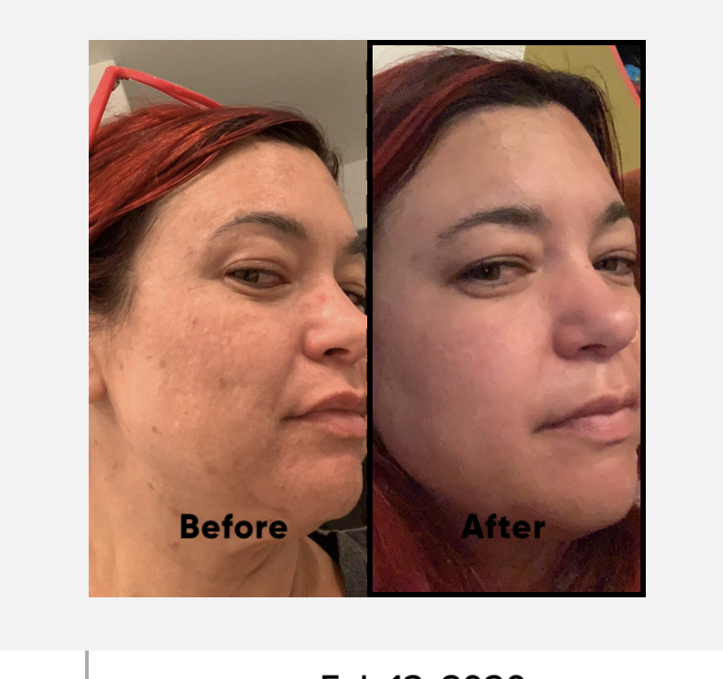 The Spot Cream review photo by Aimee M.