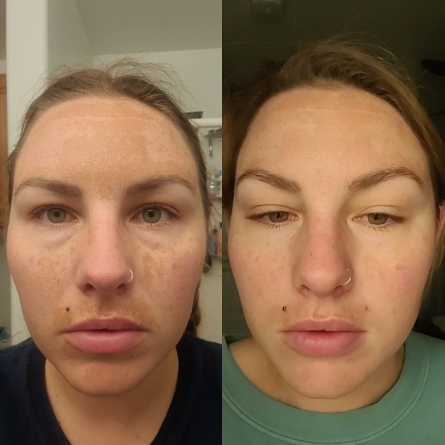 The Spot Cream review photo by Brandy H.