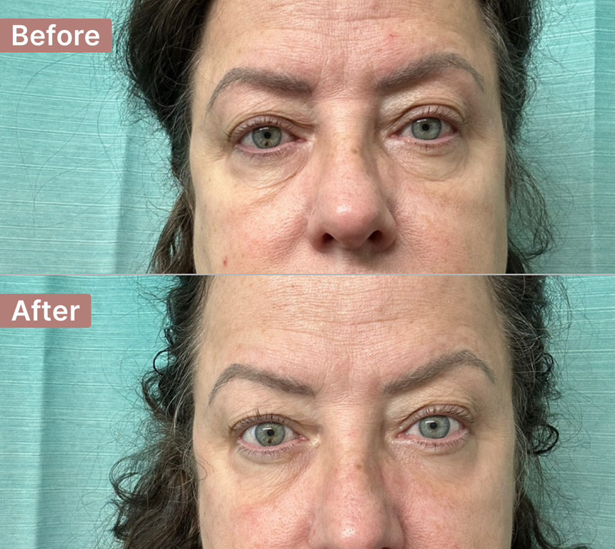 The Aging Repair Cream review photo by Beth  H.