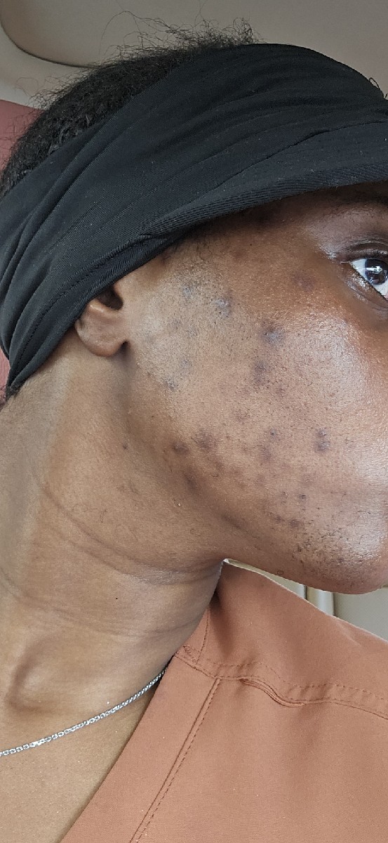 The Spot Cream review photo by Guerline J.