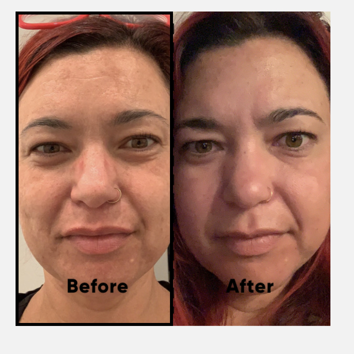The Spot Cream review photo by Aimee M.