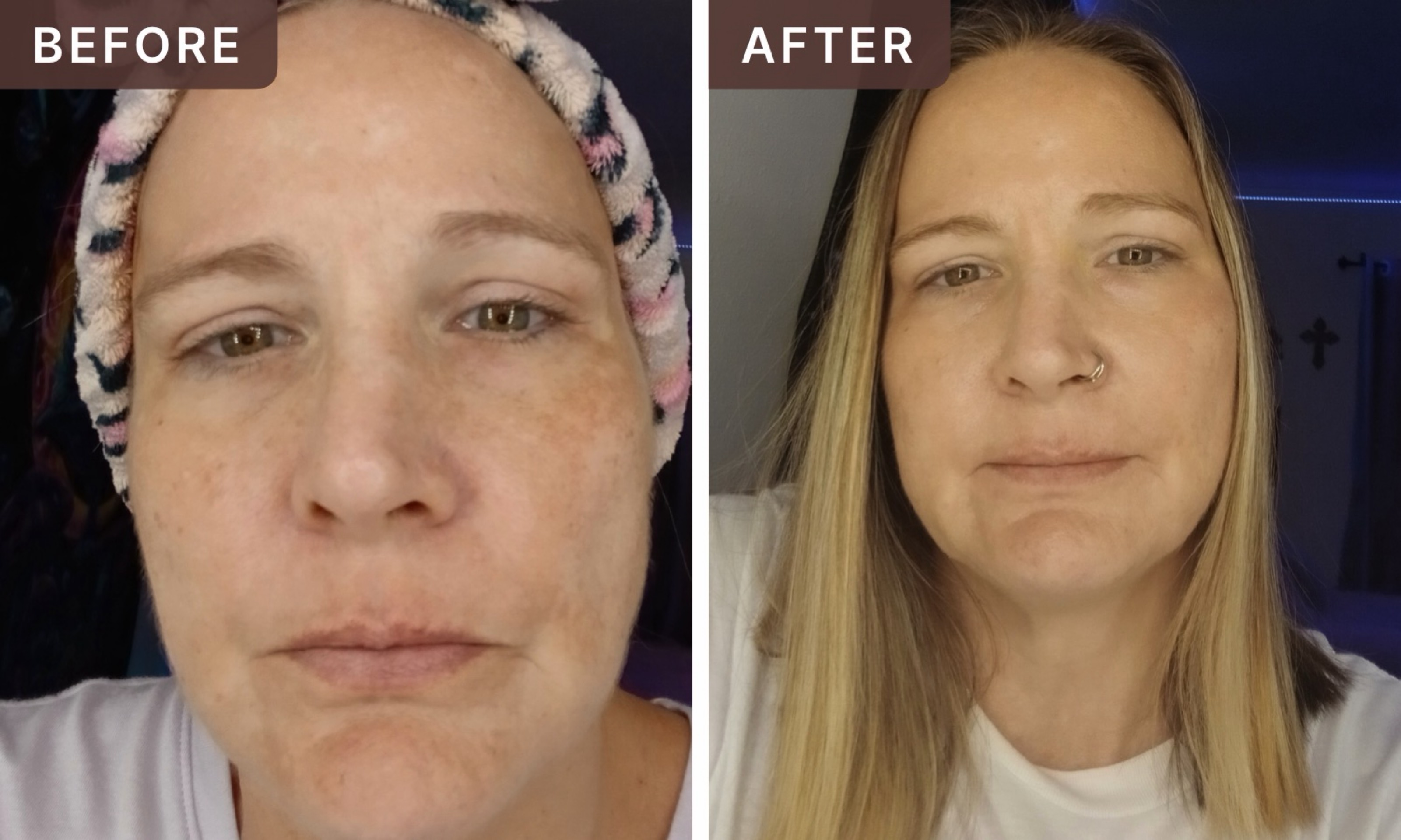 Amy💋🧚 C. -- before and after, 8 weeks