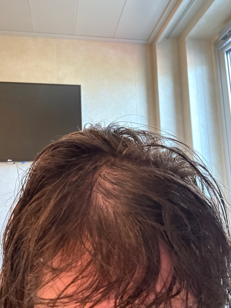 The Hair Topical Solution - Classic review photo by Michelle  C.