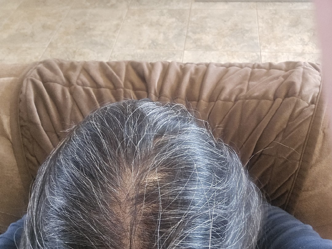 The Hair Topical Solution - Classic review photo by karen C.