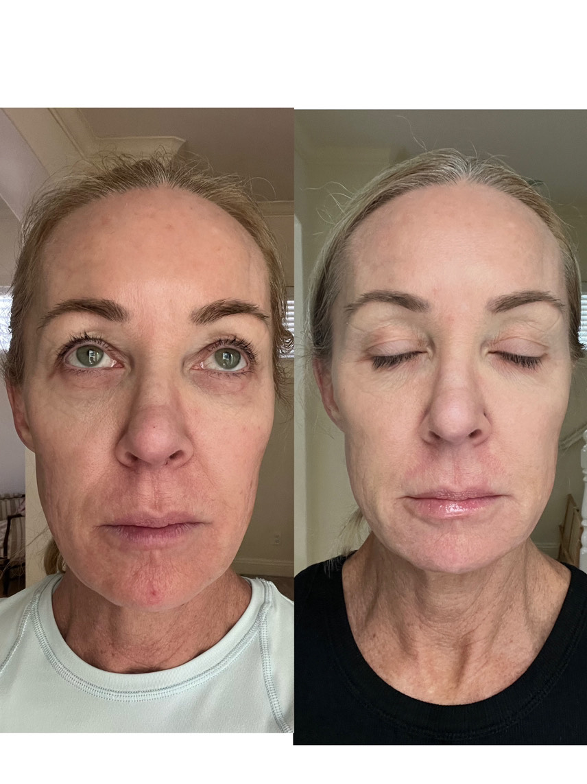 The Spot Cream review photo by Lucy F.