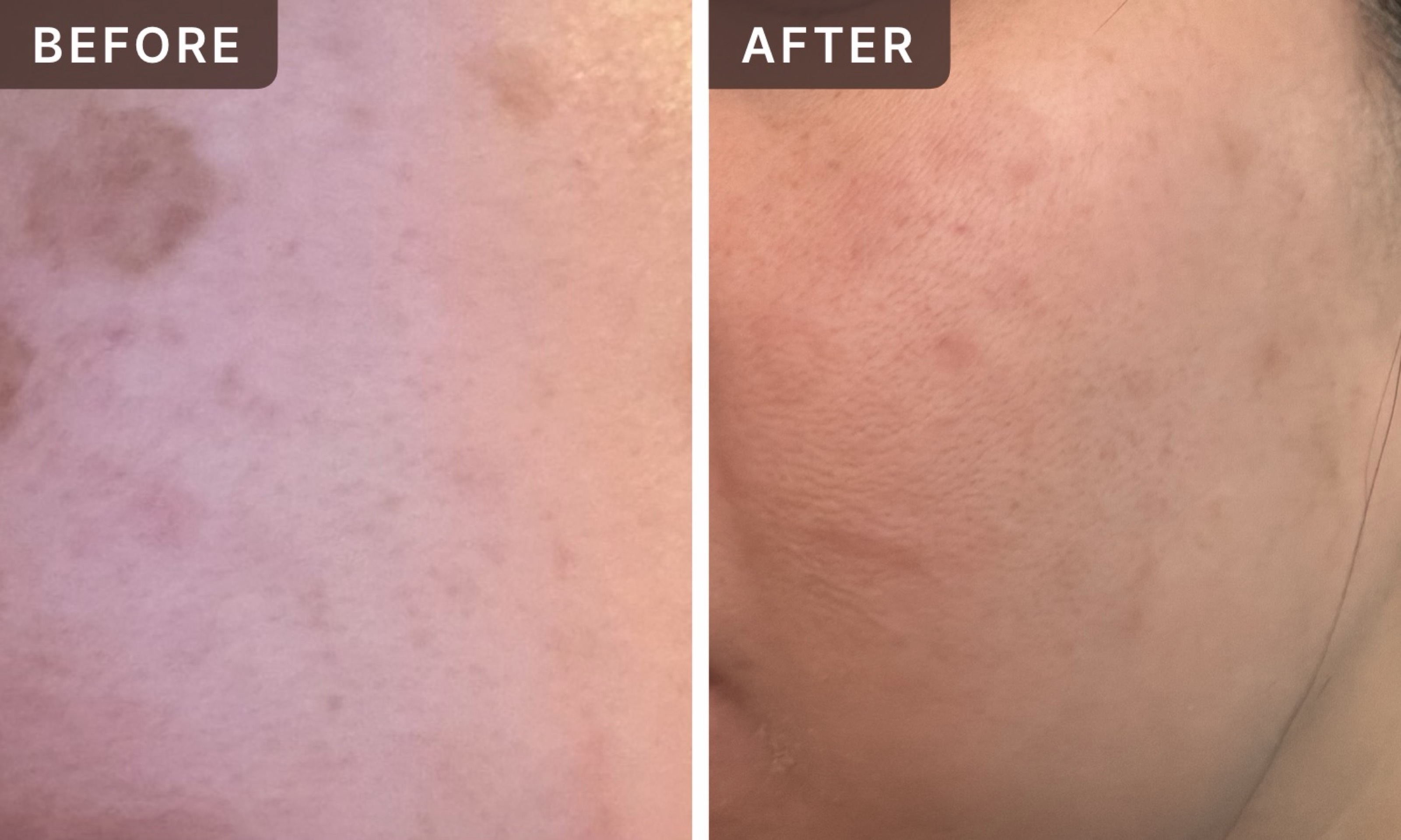 Jen N. -- before and after, 8 weeks
