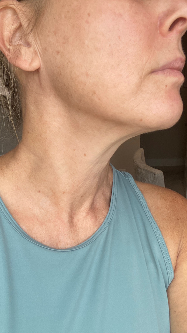 The Neck Cream review photo by Nicole I.