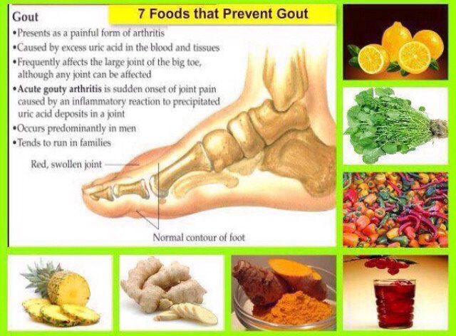 7 Foods That Prevent Gout - Musely