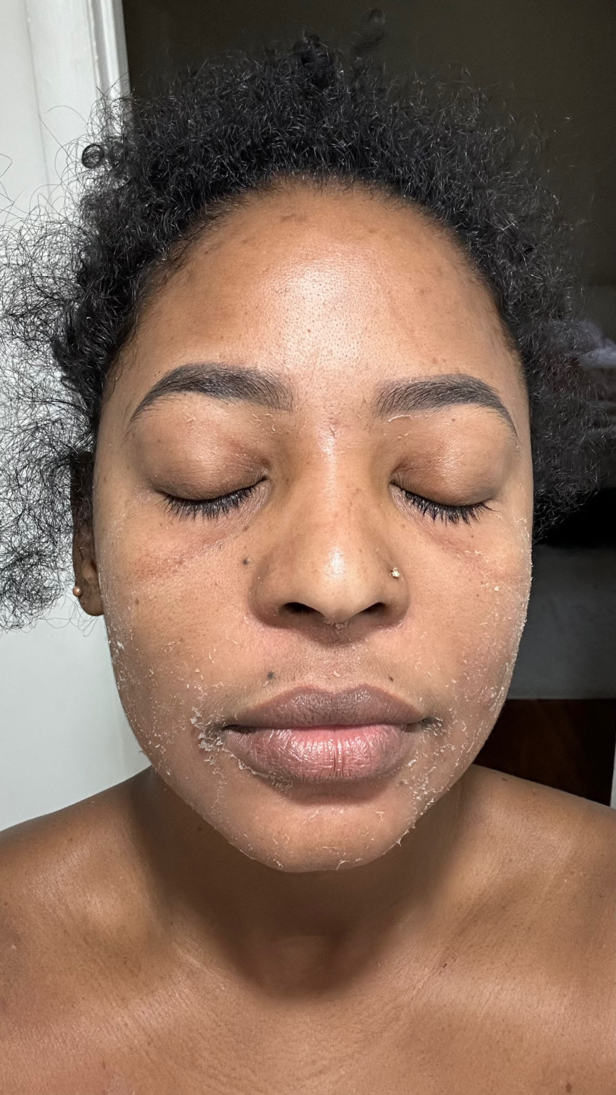 The Eye Serum review photo by ANABEL G.